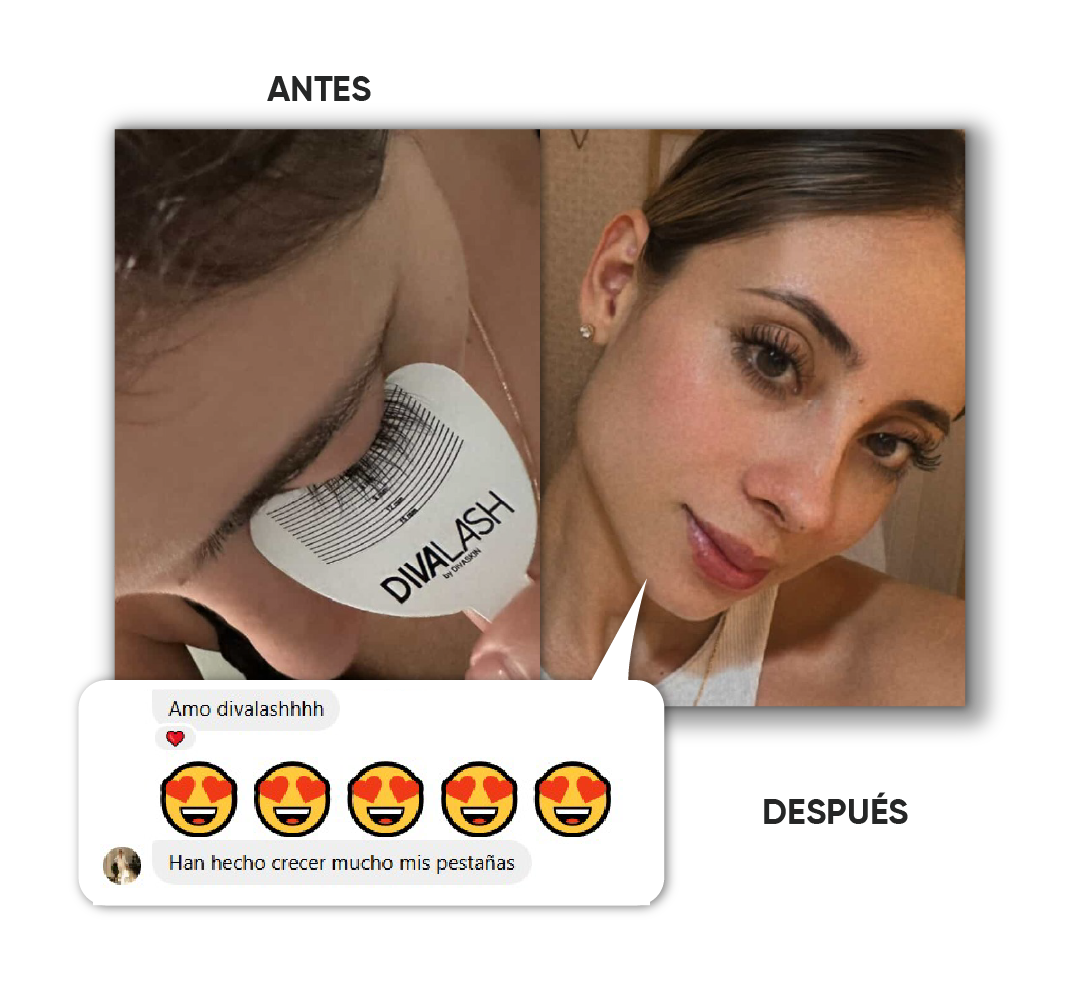 Antes y después · Caso 7