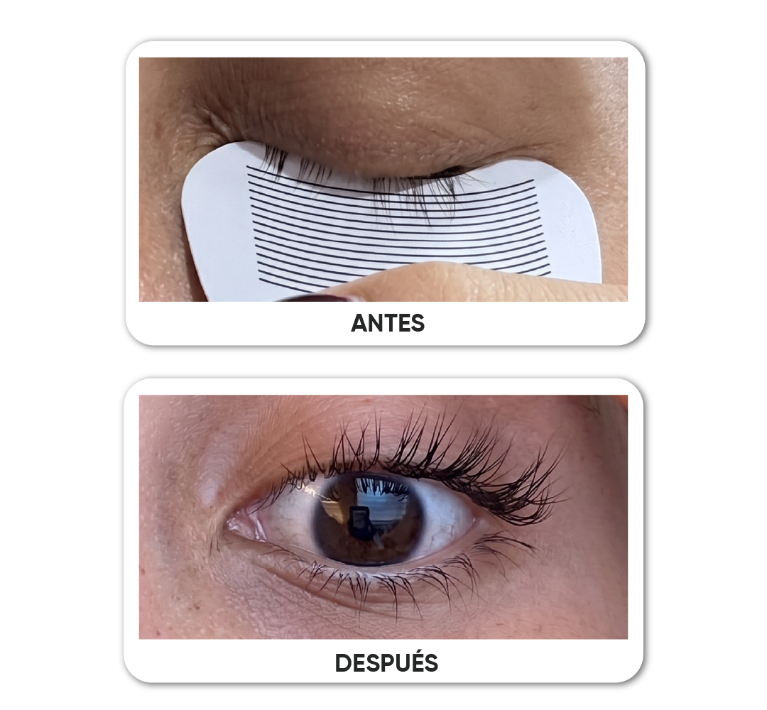 Antes y después · Caso 11