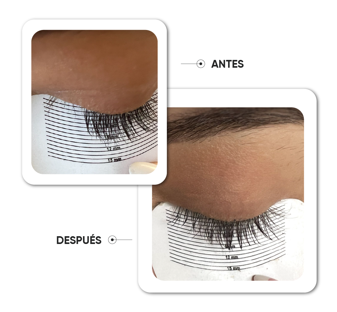 Antes y después · Caso 8