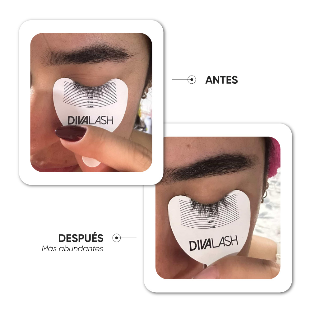 Antes y después · Caso 3