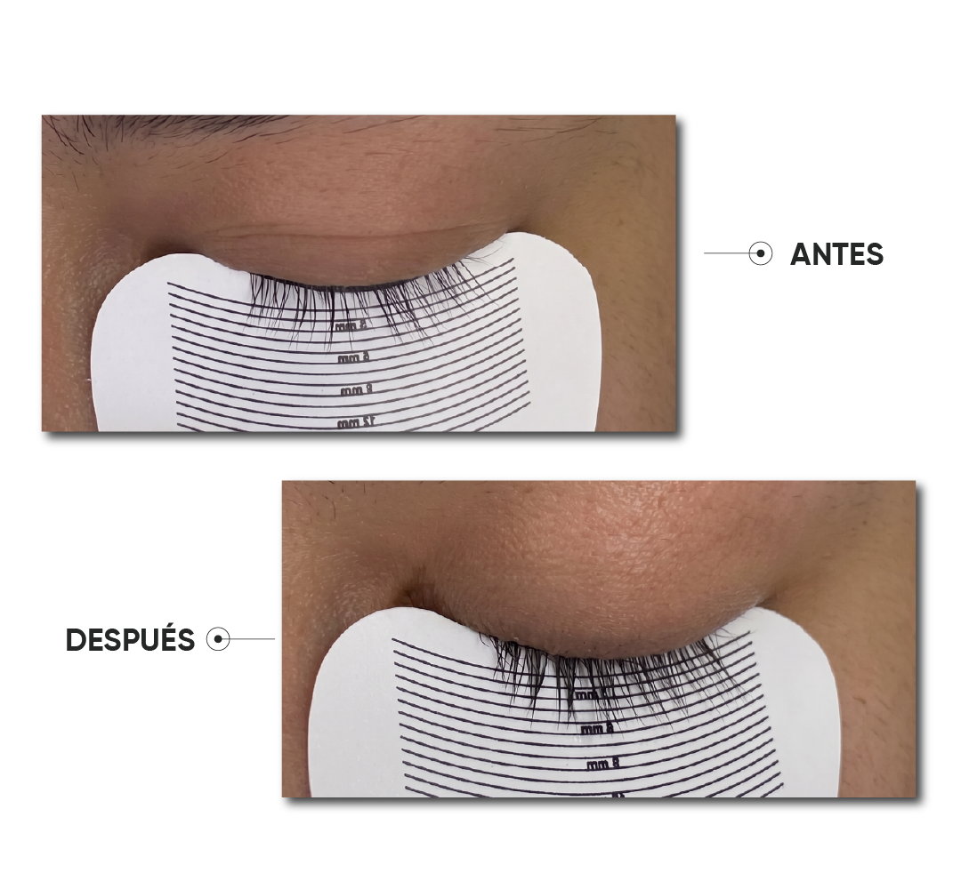 Antes y después · Caso 10