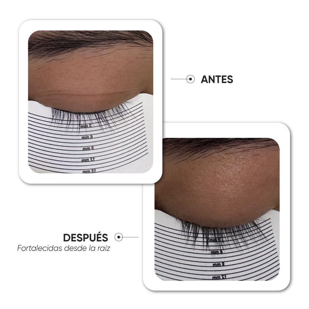 Antes y después · Caso 5