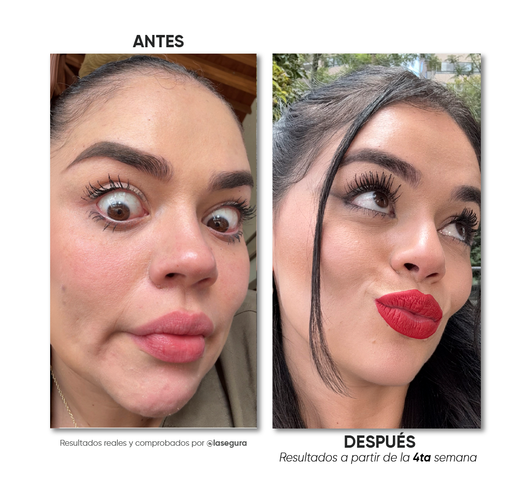 Antes y después · Caso 2