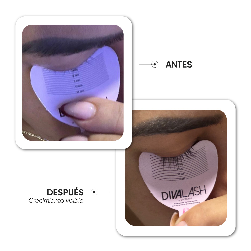 Antes y después · Caso 2
