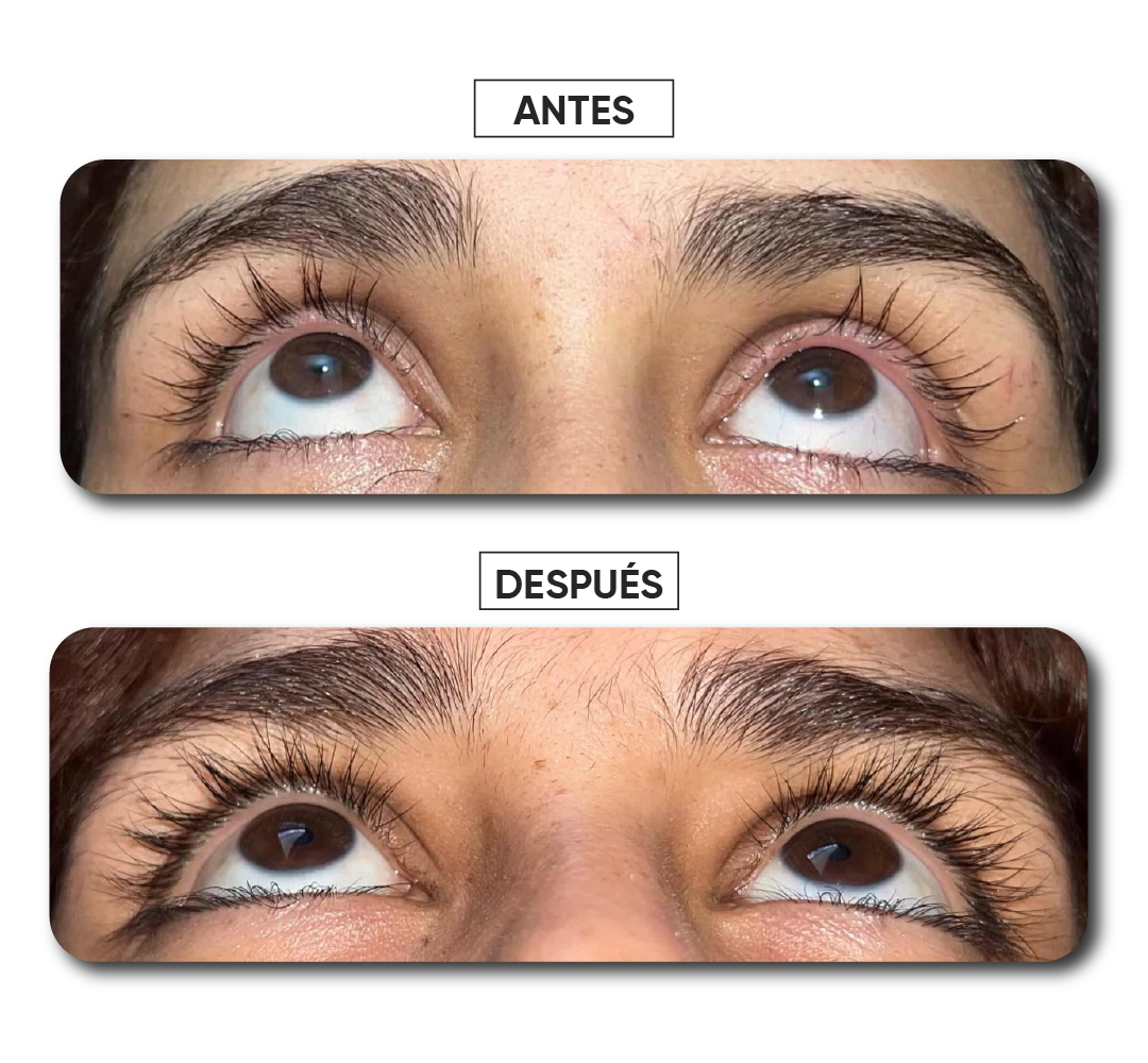 Antes y después · Caso 9